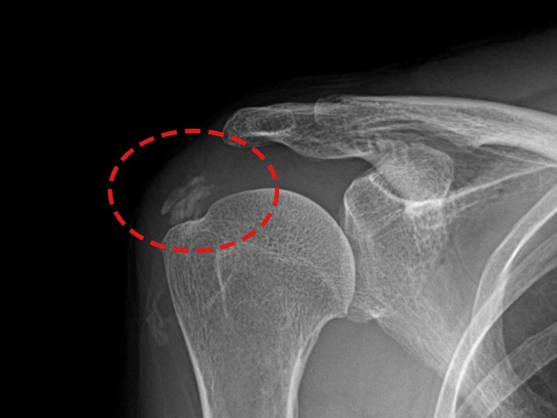 신ㅇㅇ님 시술 전