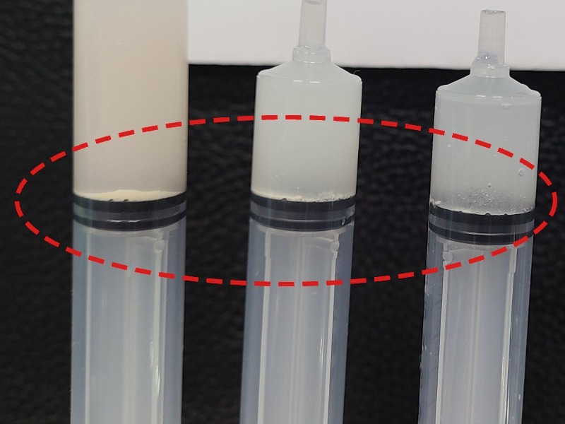 신ㅇㅇ님 제거된 석회 사진