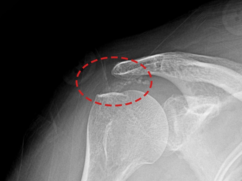 원ㅇㅇ님 시술 후