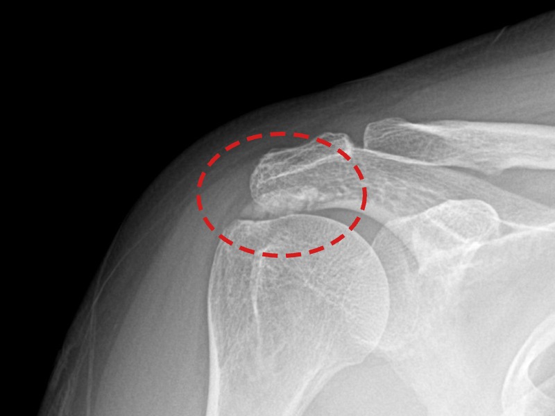 원ㅇㅇ님 시술 전