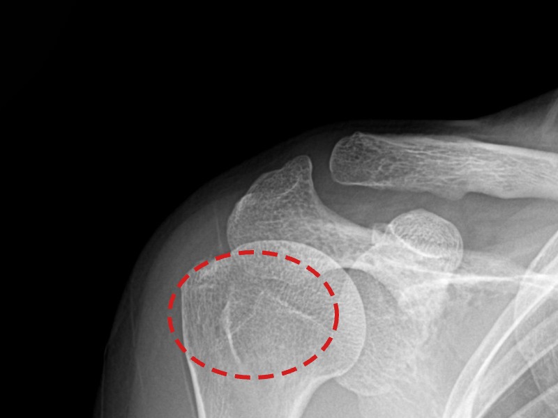 전ㅇㅇ님 시술 후