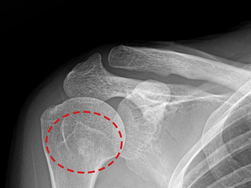 전ㅇㅇ님 시술 전