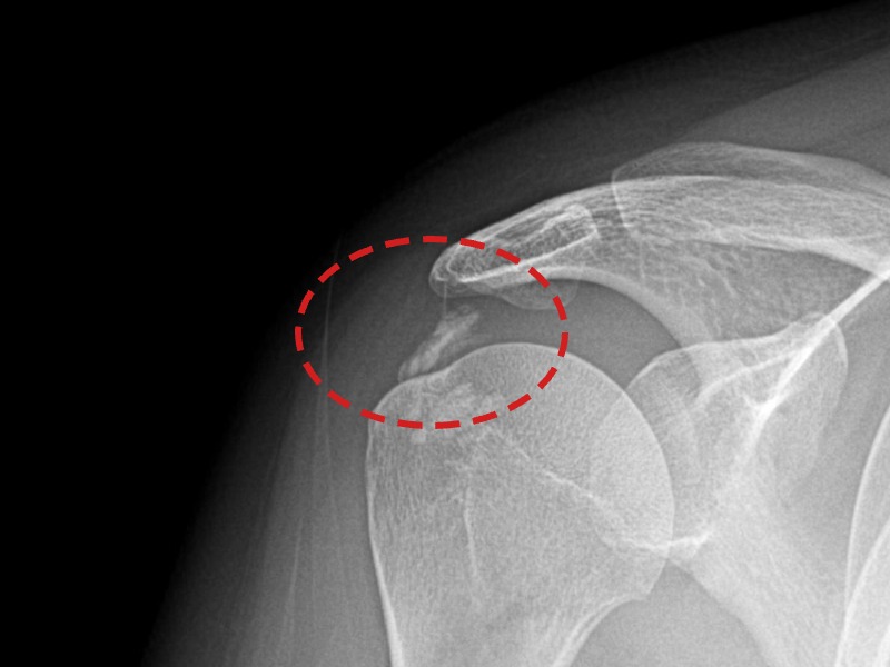 정ㅇㅇ님 시술 전