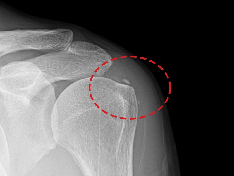 조ㅇㅇ님 시술 후