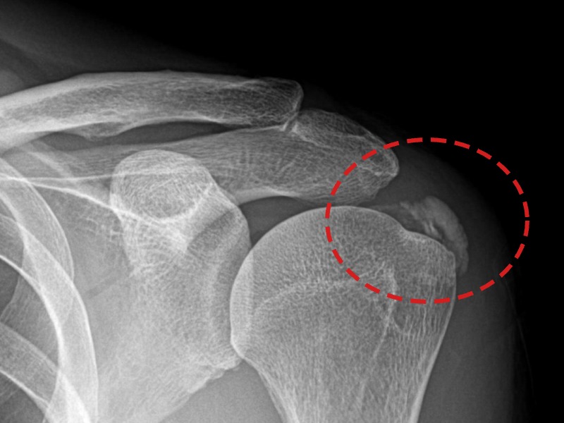 조ㅇㅇ님 시술 전