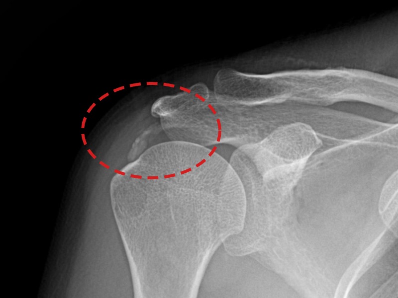 한ㅇㅇ님 시술 후