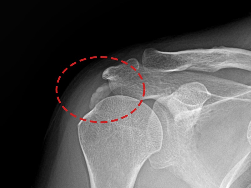 한ㅇㅇ님 시술 전